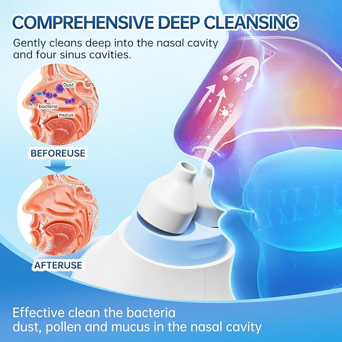 Nasopro Electric Nasal Irrigation System 2